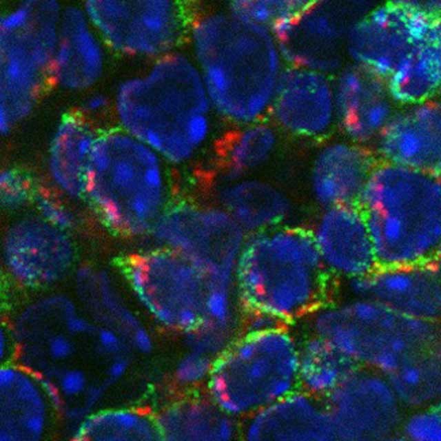 tcells