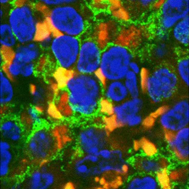 macrophages