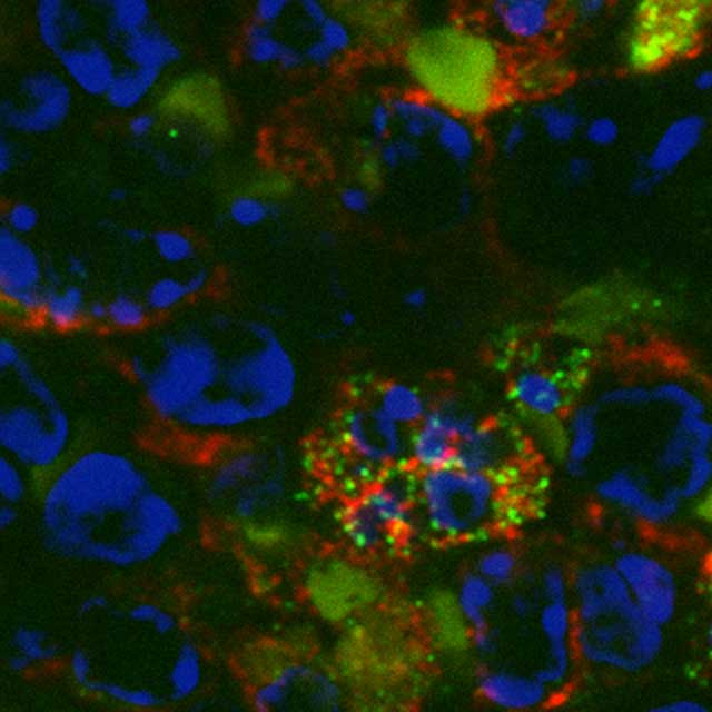 neutrophils